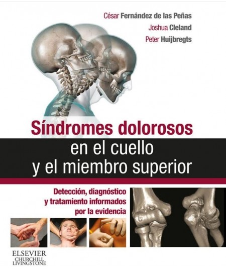 Sindromes dolorosos en el cuello y el miembro superior