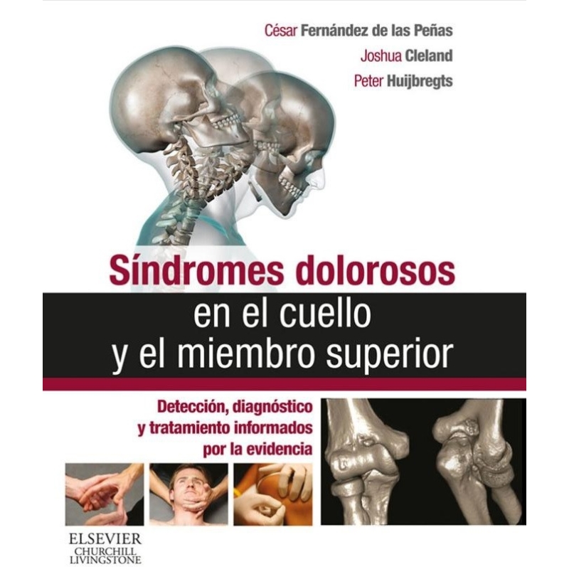 Sindromes dolorosos en el cuello y el miembro superior