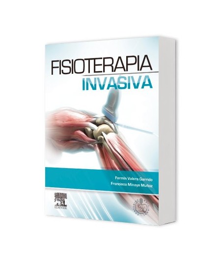 Fisioterapia Invasiva + Acceso Web