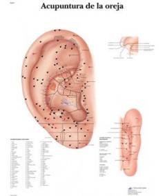 Acupuntura de la Oreja