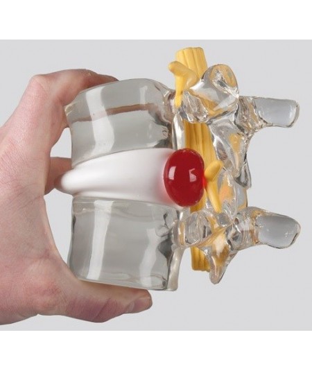 Simulador Vertebral