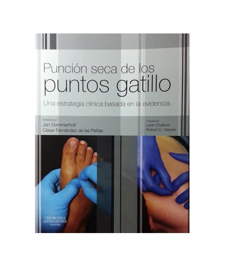 Punción seca de los puntos gatillo