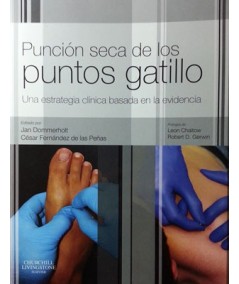 Punción seca de los puntos gatillo