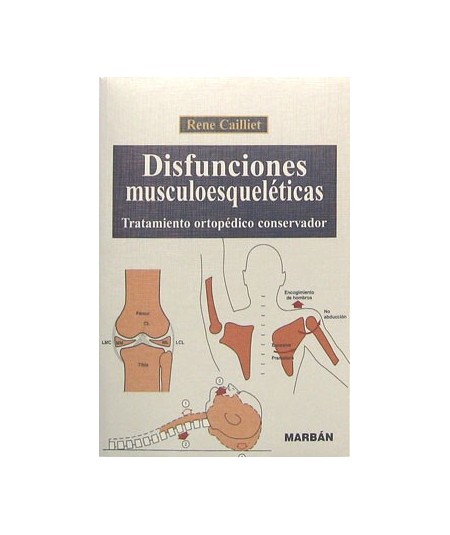 Disfunciones Musculoesqueleticas