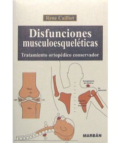 Disfunciones Musculoesqueleticas