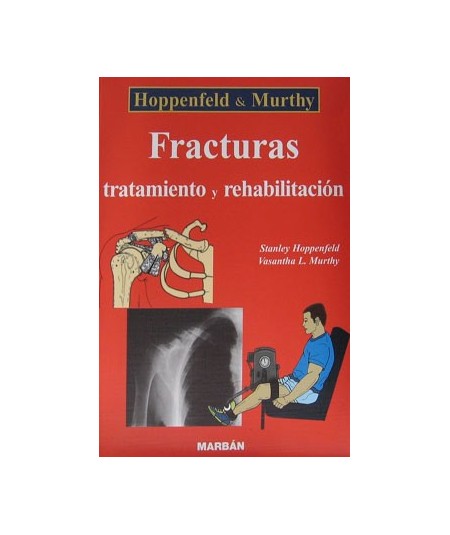 Fracturas, Tratamiento y Rehabilitacion