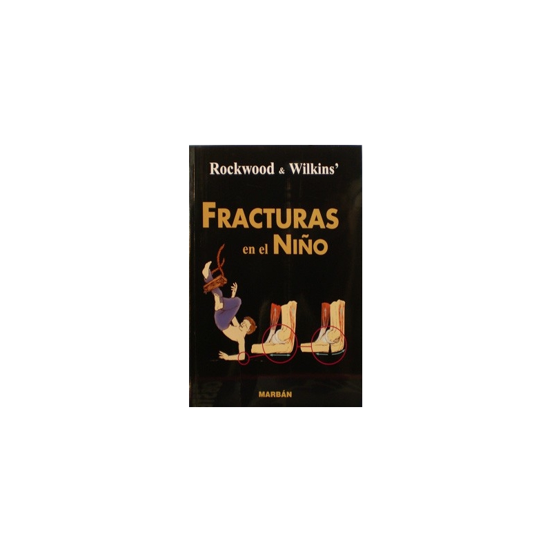 Fracturas en el Niño