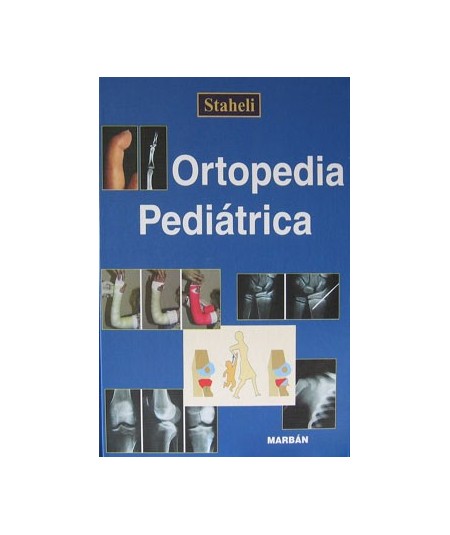 Ortopedia Pediatrica