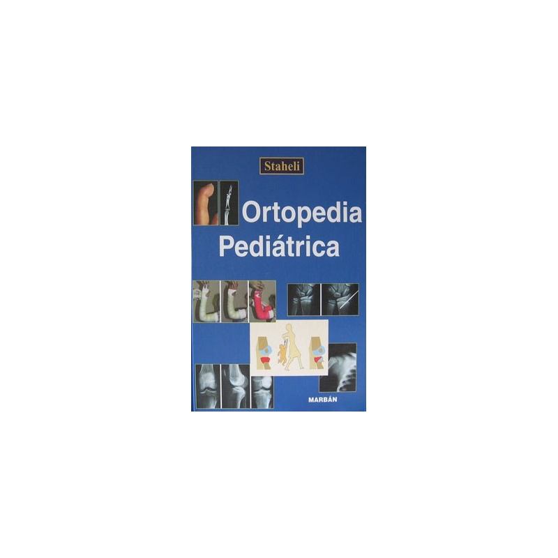 Ortopedia Pediatrica