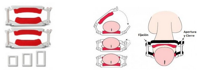 Pinza para Incontinencia Urinaria Dribblestop (Kit 2 uds)